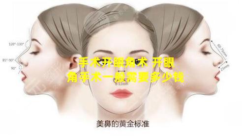 手术开眼角术 开眼角手术一般需要多少钱